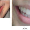 Before (left) and after (right)